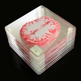 Creative Floral Brain Slices Acrylic Coasters Party Favors (Option: Brain 10Piece Set)